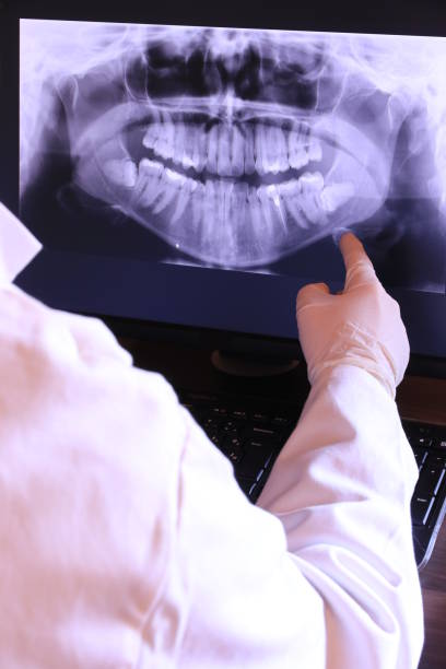 Best Same-Day Emergency Dental Services in Georgetown, CT