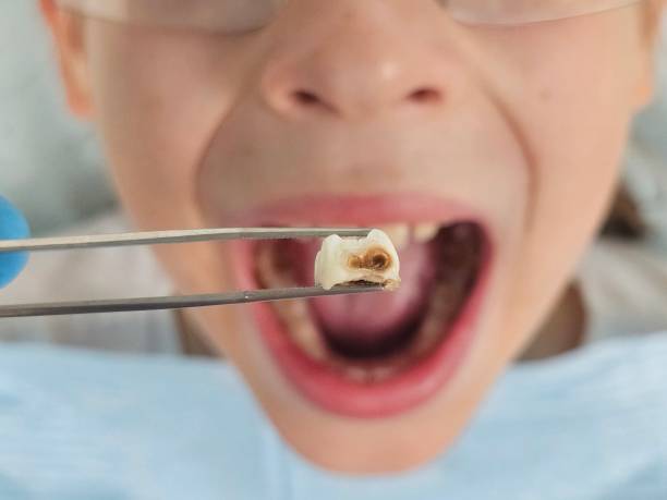 Best After-Hours Dental Trauma Care in Georgetown, CT